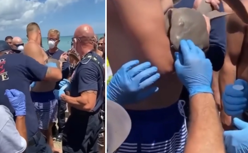 НЕВЕРОЈАТНА СНИМКА: Маж излезе од вода со закачена ајкула на раката (ВИДЕО)