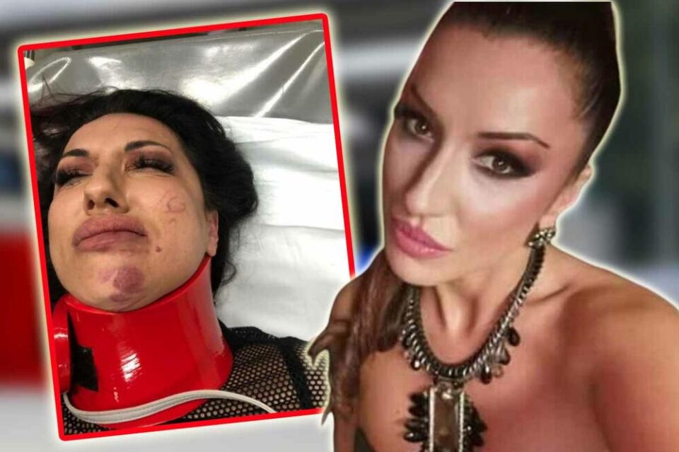 За првпат се огласи пејачката Марина, на која не ѝ е првпат да биде претепана: Лицето ми е изобличено…