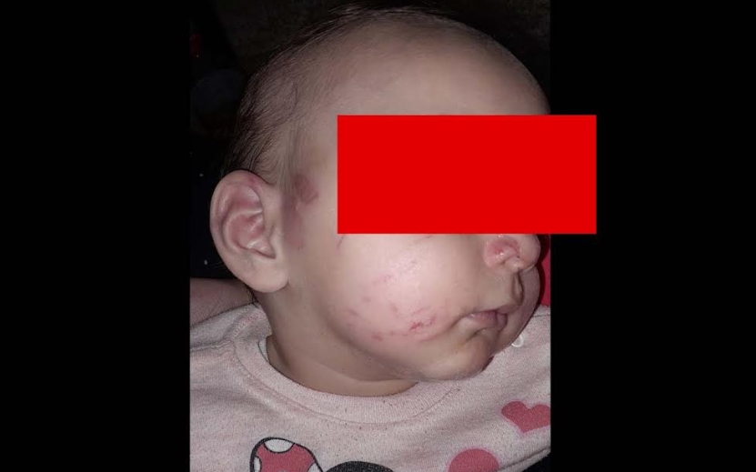 Страшен случај ја ЗГРОЗИ МАКЕДОНИЈА: Брутално насилство врз 10 месечно бебе во градинка во Гевгелија (ФОТО)
