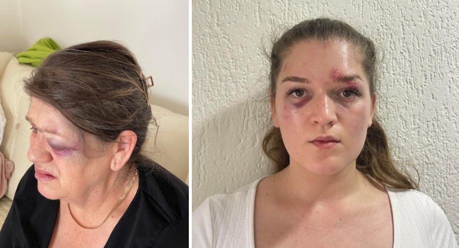 НАСИЛСТВО ЈА ЗГРОЗИ МАКЕДОНИЈА: Мајка и ќерка претепани од соседот, велат дека никој не реагира (ФОТО)