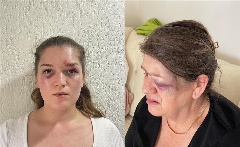 Се огласи полицијата за инцидентот во Петровец: За претепувањето на мајката и ќерката е уапсено ова лице