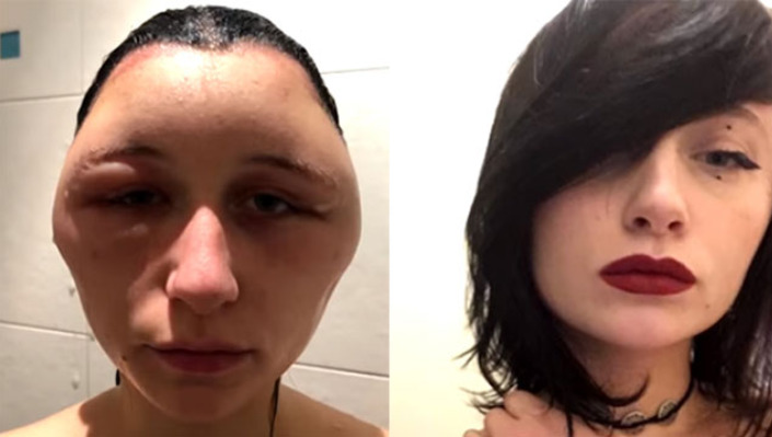 Млада Македонка доживеа голгота: Целото лице ѝ се измести, заврши со живи рани (ФОТО 16+)